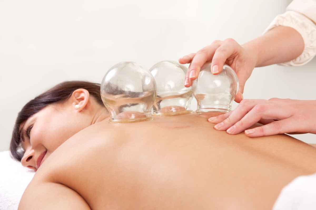 Cupping Theraphy