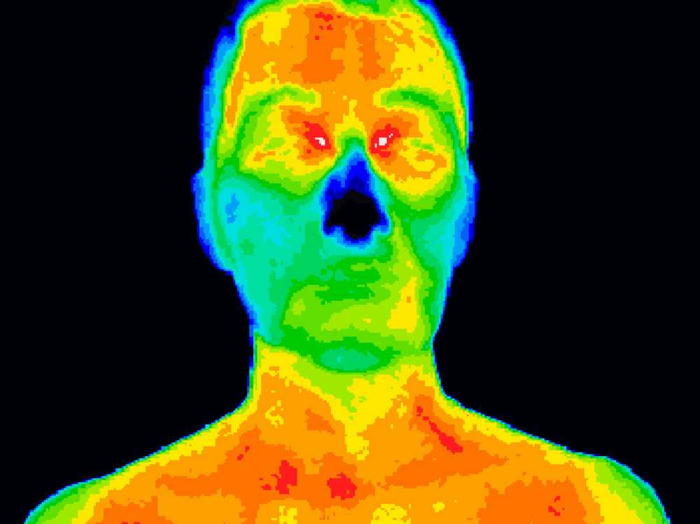 Thermography